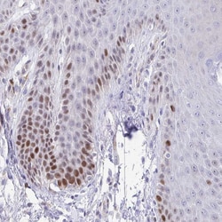 TIMELESS Polyclonal Antibody:Antibodies, Polyclonal