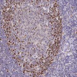 TIMELESS Polyclonal Antibody:Antibodies, Polyclonal