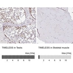 TIMELESS Polyclonal Antibody:Antibodies, Polyclonal