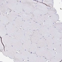 TIMELESS Polyclonal Antibody:Antibodies, Polyclonal