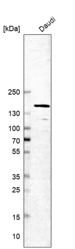 Invitrogen TIMELESS Polyclonal Antibody 100 &mu;L; Unconjugated:Antibodies,