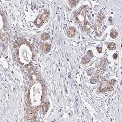Invitrogen EHF Polyclonal Antibody 100 &mu;L | Buy Online | Invitrogen&trade; | Fisher Scientific