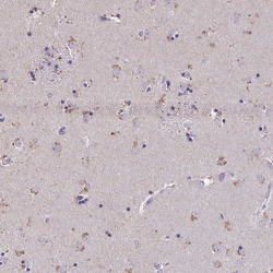 Invitrogen ZNF34 Polyclonal Antibody 100 &mu;L; Unconjugated:Antibodies,