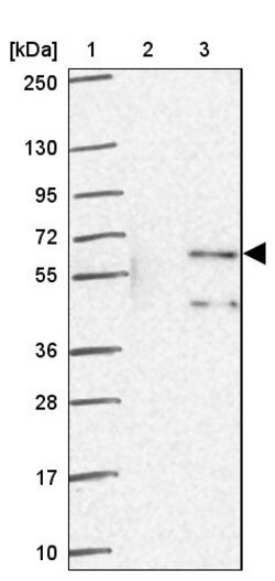 Invitrogen ZNF34 Polyclonal Antibody 100 &mu;L; Unconjugated:Antibodies,