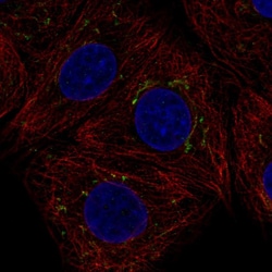 AIG1 Polyclonal Antibody:Antibodies, Polyclonal
