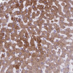 AIG1 Polyclonal Antibody:Antibodies, Polyclonal