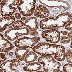 Invitrogen STARD8 Polyclonal Antibody 100 &mu;L; Unconjugated:Antibodies,