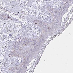 Invitrogen NAALAD2 Polyclonal Antibody 100 &mu;L; Unconjugated:Antibodies,