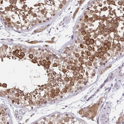 Invitrogen NAALAD2 Polyclonal Antibody 100 &mu;L; Unconjugated:Antibodies,
