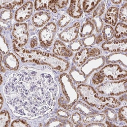 Invitrogen EXOC5 Polyclonal Antibody 100 &mu;L; Unconjugated:Antibodies,