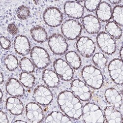 Invitrogen OR6T1 Polyclonal Antibody 100 &mu;L; Unconjugated:Antibodies,