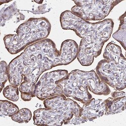 Invitrogen XAGE2 Polyclonal Antibody 100 &mu;L; Unconjugated:Antibodies,