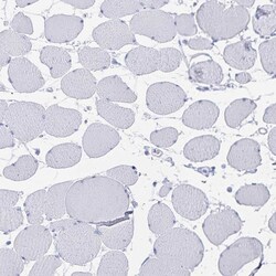 Invitrogen Alcohol Dehydrogenase 1A Polyclonal Antibody 100 &mu;L; Unconjugated:Antibodies,