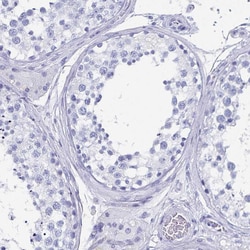 Invitrogen Alcohol Dehydrogenase 1A Polyclonal Antibody 100 &mu;L; Unconjugated:Antibodies,