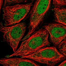 Invitrogen RIM4 Polyclonal Antibody 100 &mu;L; Unconjugated:Antibodies,