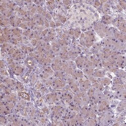Invitrogen RRS1 Polyclonal Antibody 100 &mu;L; Unconjugated:Antibodies,