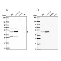 Invitrogen RRS1 Polyclonal Antibody 100 &mu;L; Unconjugated:Antibodies,