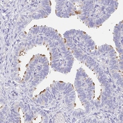 AKAP14 Polyclonal Antibody:Antibodies, Polyclonal