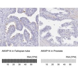 AKAP14 Polyclonal Antibody:Antibodies, Polyclonal