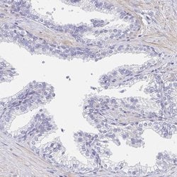 AKAP14 Polyclonal Antibody:Antibodies, Polyclonal