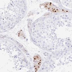 Invitrogen HINFP Polyclonal Antibody 100 &mu;L; Unconjugated:Antibodies,