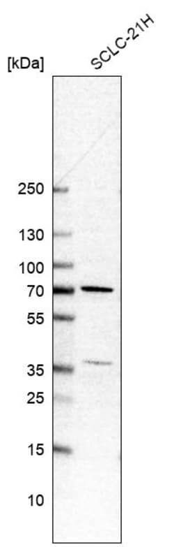 Invitrogen HINFP Polyclonal Antibody 100 &mu;L | Buy Online | Invitrogen&trade; | Fisher Scientific