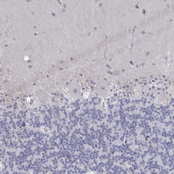 Invitrogen C15orf41 Polyclonal Antibody 100 &mu;L; Unconjugated:Antibodies,