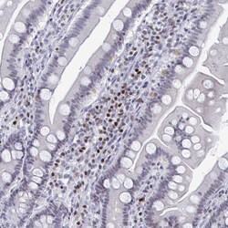 Invitrogen C15orf41 Polyclonal Antibody 100 &mu;L; Unconjugated:Antibodies,