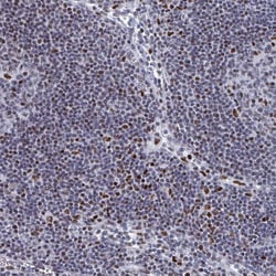 Invitrogen C15orf41 Polyclonal Antibody 100 &mu;L; Unconjugated:Antibodies,