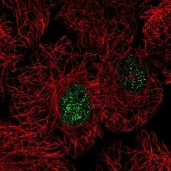 Invitrogen C15orf41 Polyclonal Antibody 100 &mu;L; Unconjugated:Antibodies,
