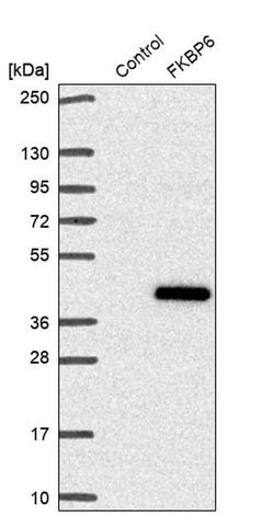 FKBP6 Polyclonal Antibody:Antibodies, Polyclonal