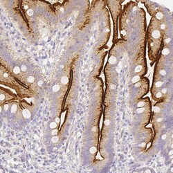 Invitrogen ASAH2 Polyclonal Antibody 100 &mu;L; Unconjugated:Antibodies,