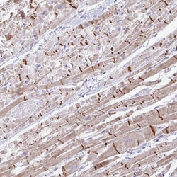 Invitrogen ZNF736 Polyclonal Antibody 100 &mu;L; Unconjugated:Antibodies,