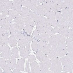 Invitrogen PSORS1C2 Polyclonal Antibody 100 &mu;L; Unconjugated:Antibodies,