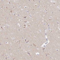 Invitrogen OR51D1 Polyclonal Antibody 100 &mu;L; Unconjugated:Antibodies,