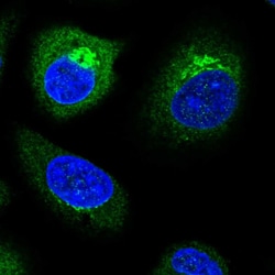 TP53I11 Polyclonal Antibody