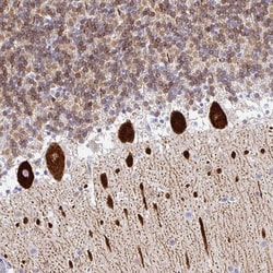 TP53I11 Polyclonal Antibody