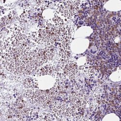 BPI Polyclonal Antibody:Antibodies, Polyclonal