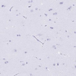 BPI Polyclonal Antibody:Antibodies, Polyclonal