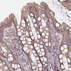 ARHGEF39 Polyclonal Antibody:Antibodies, Polyclonal