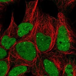 Invitrogen GTF3C6 Polyclonal Antibody 100 &mu;L; Unconjugated:Antibodies,