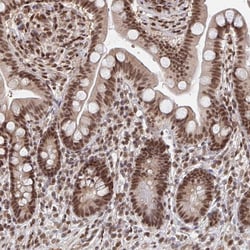 Invitrogen GTF3C6 Polyclonal Antibody 100 &mu;L; Unconjugated:Antibodies,