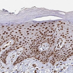 Invitrogen GTF3C6 Polyclonal Antibody 100 &mu;L; Unconjugated:Antibodies,
