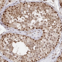 Invitrogen GTF3C6 Polyclonal Antibody 100 &mu;L; Unconjugated:Antibodies,