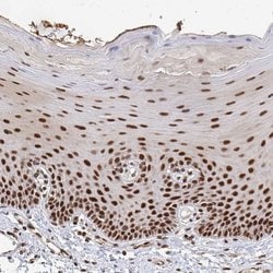 Invitrogen GTF3C6 Polyclonal Antibody 100 &mu;L; Unconjugated:Antibodies,