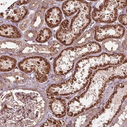 Invitrogen CEP95 Polyclonal Antibody 100 &mu;L; Unconjugated:Antibodies,