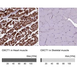 OXCT1 Polyclonal Antibody:Antibodies, Polyclonal