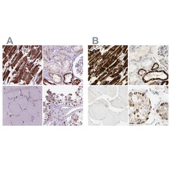 OXCT1 Polyclonal Antibody:Antibodies, Polyclonal
