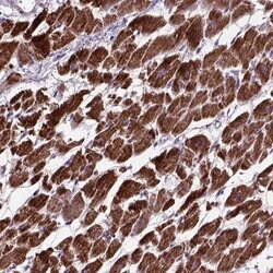 OXCT1 Polyclonal Antibody:Antibodies, Polyclonal
