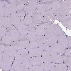 OXCT1 Polyclonal Antibody:Antibodies, Polyclonal